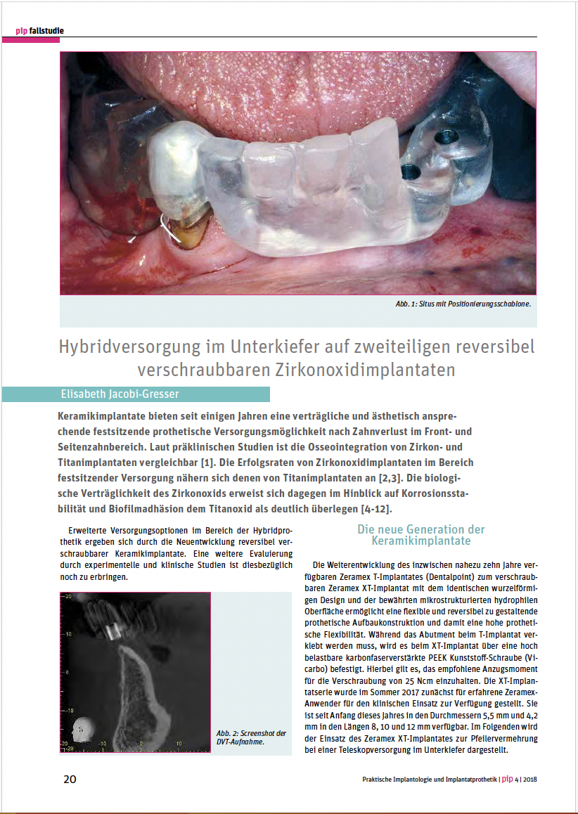 Hybridversorgung im Unterkiefer auf zweiteiligen reversibel verschraubbaren Zirkonoxidimplantaten – Dr. Elisabeth Jacobi-Gresser