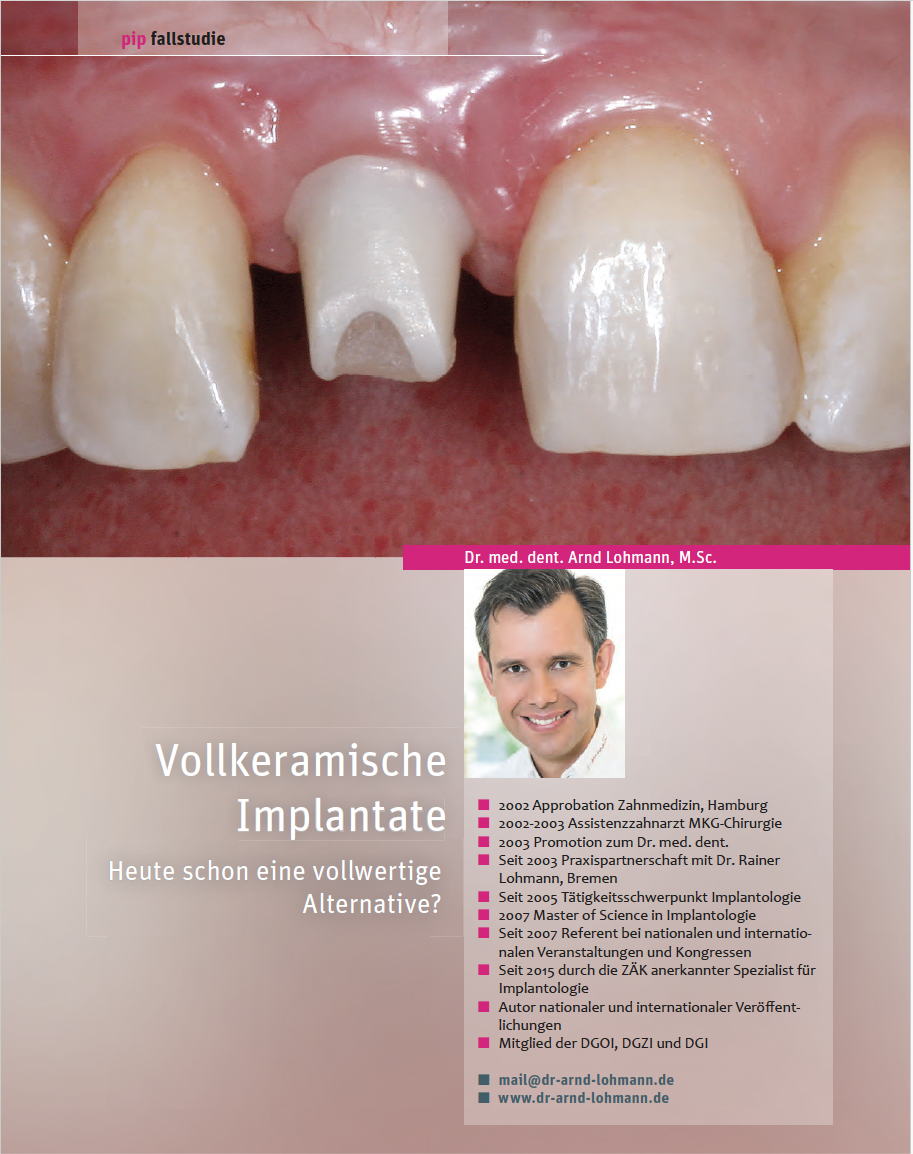 Vollkeramische Implantate: Heute schon eine vollwertige Alternative? – Dr. Arnd Lohmann